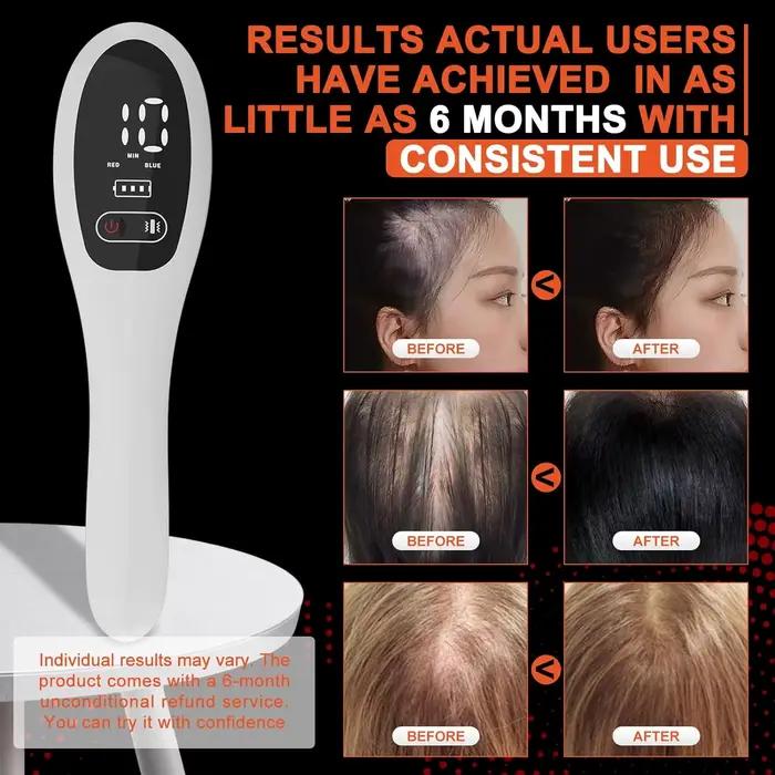 Peigne Laser Électrique pour la Croissance des Cheveux, Thérapie Anti-Perte de Cheveux, Infrarouge 6