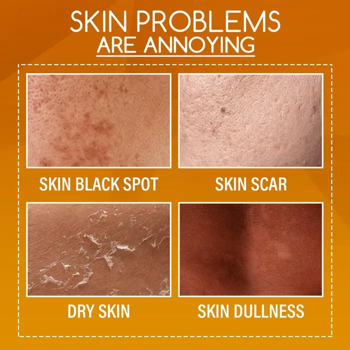 Lotion Peeling à l'orange pour la peau foncée