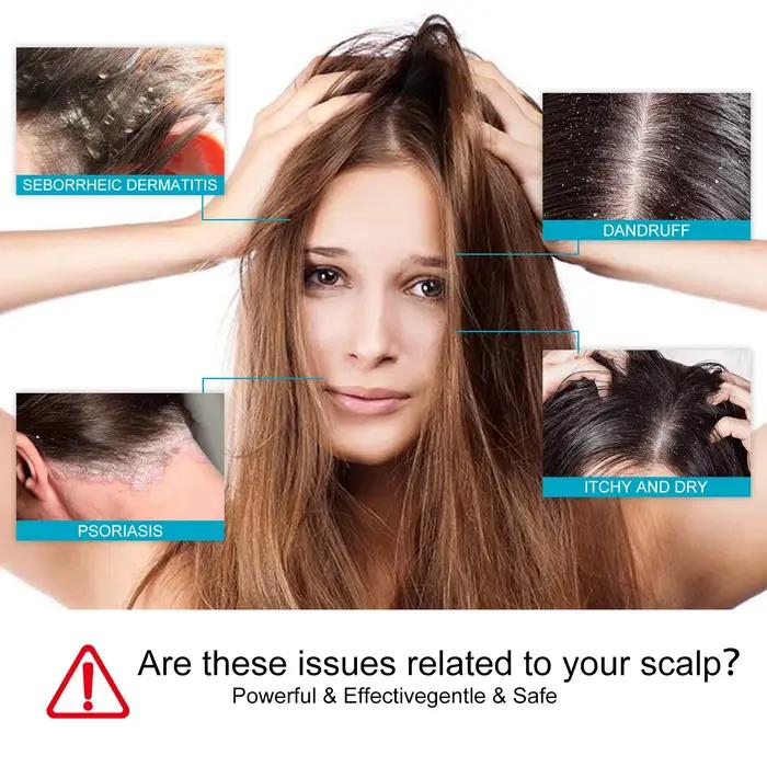 Shampoo antipelliculaire Hoegoa