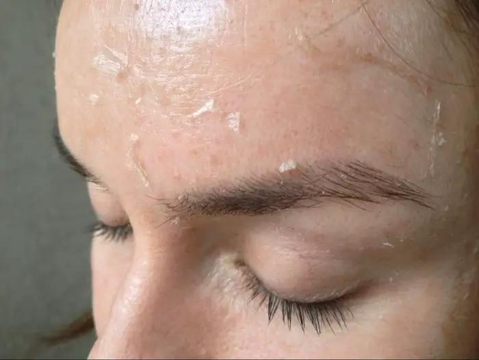Huile exfoliante pour les taches de peau foncées
