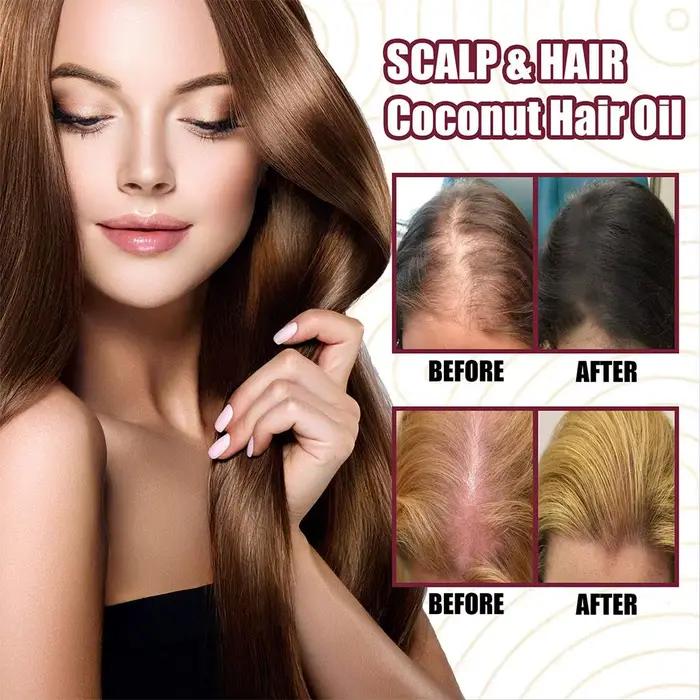 Spray d'huile essentielle d'oignon rouge pour soins capillaires