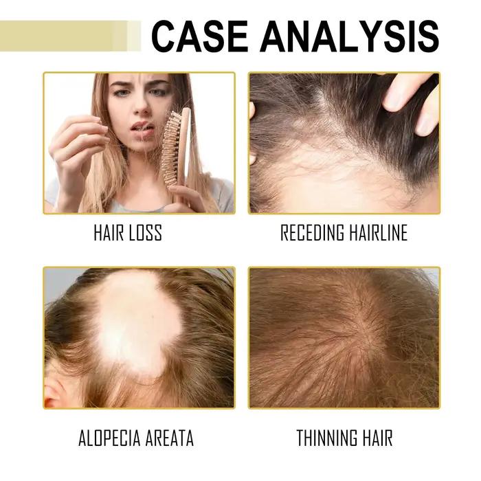 Huile essentielle de romarin pour cheveux denses