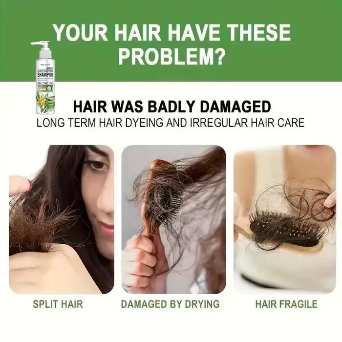 Shampoing clarifiant pour cuir chevelu sans sulfate Water Ice Levin avec huile d'arbre à thé et aloès – Hydrate