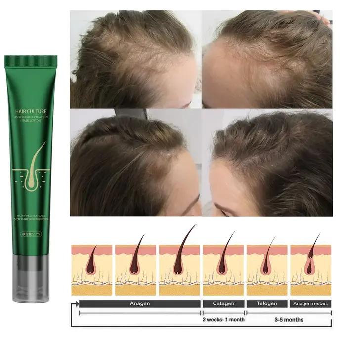 Huile essentielle de soin capillaire au gingembre naturel