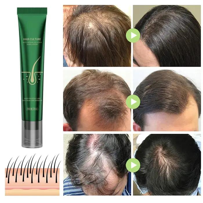 Huile essentielle de soin capillaire au gingembre naturel