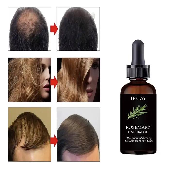 TRSTAY – huile essentielle de romarin pour le soin des cheveux