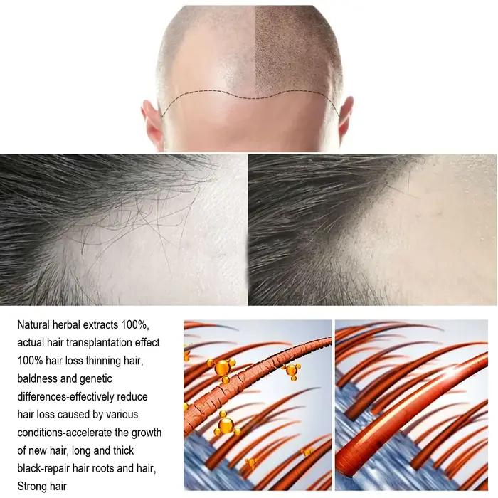 Huile essentielle de soin capillaire au gingembre naturel