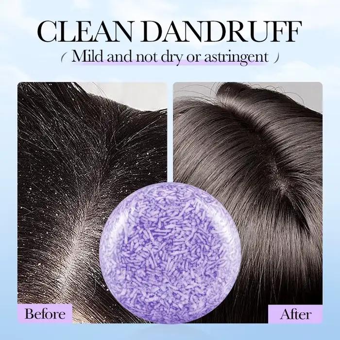 SADOER Savon Solide Capillaire à la Lavande – Shampooing Anti-Croûtes et Séborégulateur pour Cheveux Secs et Abîmés –